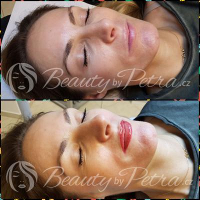 Před a po tetování permanentního makeupu rtů - kontura a výplň